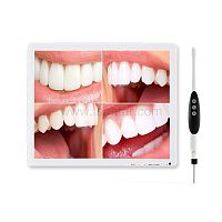 Intraoral camera D70-PLUSdigitalCMOSUSB