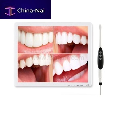 Intraoral camera D70-PLUSdigitalCMOSUSB