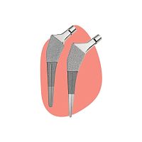 Minimally invasive hip prosthesis ANTHOLOGYcementless