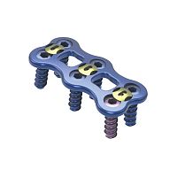 Cervical arthrodesis plate G-T652titanium