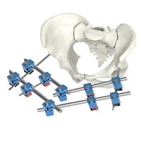 Pelvis external fixation system tubularadultpediatric
