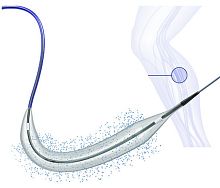PTA catheter BIOPATH 014peripheralarterialfemoral artery