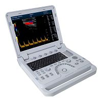 Portable ultrasound system CMS1700Bfor multipurpose ultrasound imagingfor gynecological and obstetric ultrasound imagingfor abdominal and pelvic ultrasound imaging