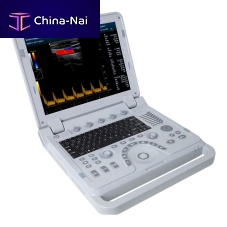 Portable ultrasound system CMS1700Bfor multipurpose ultrasound imagingfor gynecological and obstetric ultrasound imagingfor abdominal and pelvic ultrasound imaging