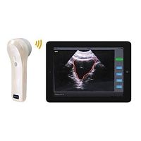 Portable bladder scanner BProbe-2