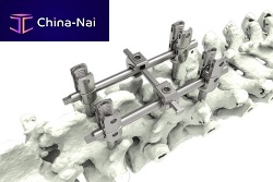 Thoracic-lumbar vertebra pedicle screw M10-Iapolyaxialmonoaxialtitanium