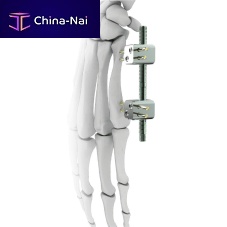 Metacarpophalangeal joint external fixation system minifixtubularpediatric