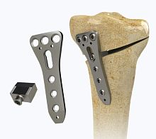 Tibia osteotomy plate 1972-0016proximalmediallocking