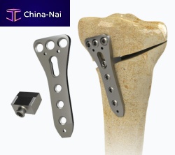 Tibia osteotomy plate 1972-0016proximalmediallocking