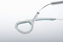 Mitral valve cardiac restoration system KALIOS