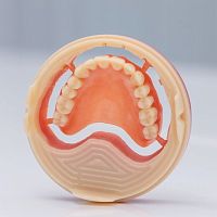 Gingival medical model Ivotion®denturejawdental