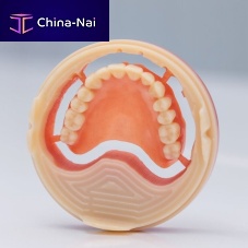 Gingival medical model Ivotion®denturejawdental