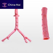 Iliac artery vascular bioprosthesis CryoArtery®allografttwo-branch