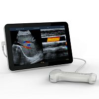 Hand-held ultrasound system UCLfor abdominal and pelvic ultrasound imagingfor urology ultrasound imagingfor emergency medicine ultrasound imaging