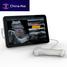 Hand-held ultrasound system UCLfor abdominal and pelvic ultrasound imagingfor urology ultrasound imagingfor emergency medicine ultrasound imaging