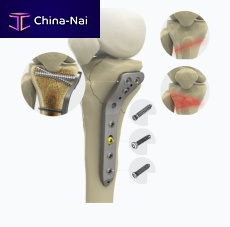 Proximal compression plate 1572 seriestibiamediallocking