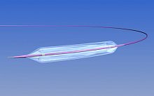 PTA catheter MERAK LDperipheralballoon6 FR
