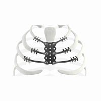Osteosarcoma resection reconstruction rib prosthesis TRIONYX®