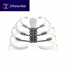 Osteosarcoma resection reconstruction rib prosthesis TRIONYX®