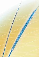 Coronary stent Coral®cobalt-chromium