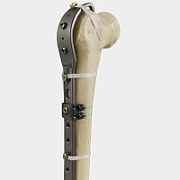 Femoral periprosthetic plate Ortholox® trochanterfemoralproximal