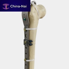 Femoral periprosthetic plate Ortholox® trochanterfemoralproximal