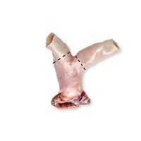 Pulmonary artery vascular bioprosthesis CardioGraft®allograft