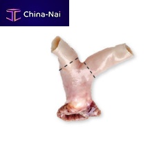 Pulmonary artery vascular bioprosthesis CardioGraft®allograft