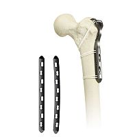 Hip revision surgery bone cerclage wiring SuperCable® Iso-Elasticmultifilament polymer
